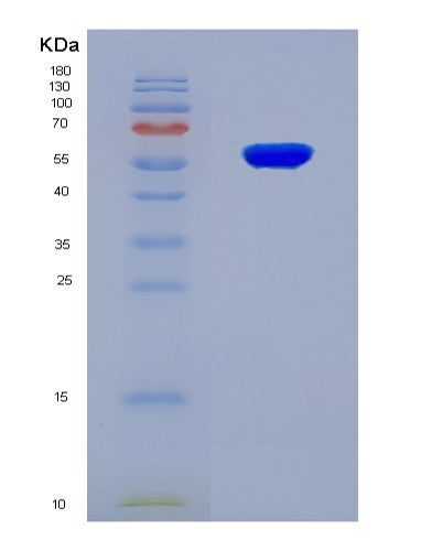 SDS-PAGE analysis of Human CDR1 (Cerebellar Degeneration-Related Antigen 1) - Recombinant Protein, showing >90% purity under 15% SDS-PAGE (Reduced)