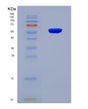 SDS-PAGE analysis of Human CDR1 (Cerebellar Degeneration-Related Antigen 1) - Recombinant Protein, showing >90% purity under 15% SDS-PAGE (Reduced)