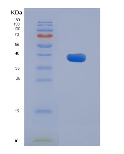 SDS-PAGE analysis of Mouse Aadat (Kynurenine/Alpha-Aminoadipate Aminotransferase, Mitochondrial) - Recombinant Protein, showing >90% purity under 15% SDS-PAGE (Reduced)