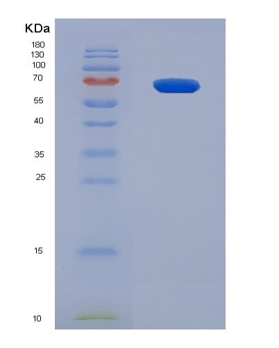 SDS-PAGE analysis of Human NEFL (Neurofilament Light Polypeptide) - Recombinant Protein, showing >90% purity under 15% SDS-PAGE (Reduced)