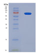 SDS-PAGE analysis of Human NEFL (Neurofilament Light Polypeptide) - Recombinant Protein, showing >90% purity under 15% SDS-PAGE (Reduced)