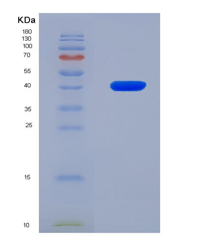 SDS-PAGE analysis of Human SCD (Stearoyl-Coa Desaturase) - Recombinant Protein, showing >90% purity under 15% SDS-PAGE (Reduced)