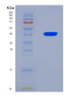SDS-PAGE analysis of Human SCD (Stearoyl-Coa Desaturase) - Recombinant Protein, showing >90% purity under 15% SDS-PAGE (Reduced)