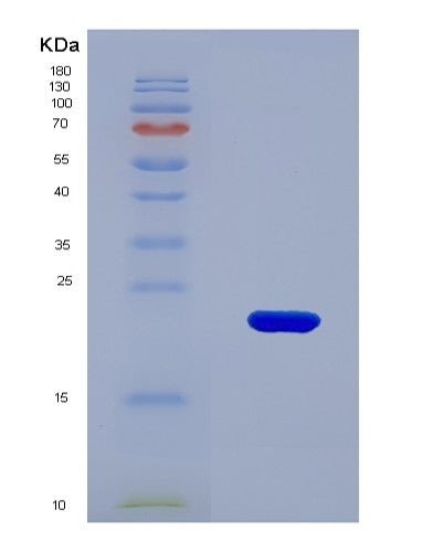 SDS-PAGE analysis of Mouse Npy1r (Neuropeptide Y Receptor Type 1) - Recombinant Protein, showing >90% purity under 15% SDS-PAGE (Reduced)
