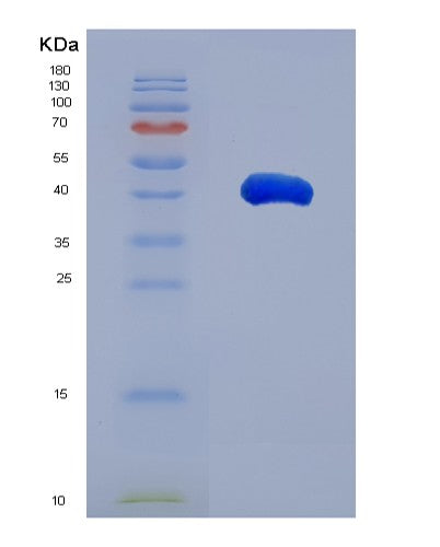 SDS-PAGE analysis of Human ST3GAL6 (Type 2 Lactosamine Alpha-2,3-Sialyltransferase) - Recombinant Protein, showing >90% purity under 15% SDS-PAGE (Reduced)