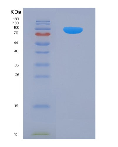SDS-PAGE analysis of Human AP2B1 (Ap-2 Complex Subunit Beta) - Recombinant Protein, showing >90% purity under 15% SDS-PAGE (Reduced)