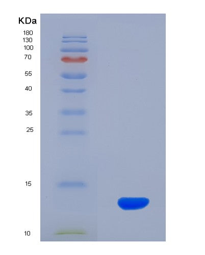 SDS-PAGE analysis of Human ADM2 (Protein Adm2) - Recombinant Protein, showing >90% purity under 15% SDS-PAGE (Reduced)