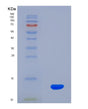 SDS-PAGE analysis of Human ADM2 (Protein Adm2) - Recombinant Protein, showing >90% purity under 15% SDS-PAGE (Reduced)