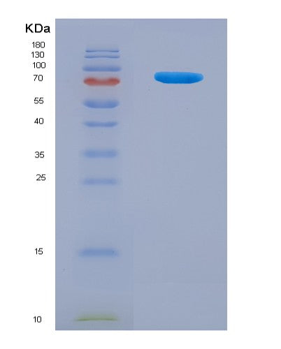 SDS-PAGE analysis of Mouse Pkm (Pyruvate Kinase Pkm) - Recombinant Protein, showing >90% purity under 15% SDS-PAGE (Reduced)