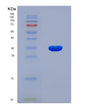 SDS-PAGE analysis of Human F8 (Coagulation Factor Viii) - Recombinant Protein, showing >90% purity under 15% SDS-PAGE (Reduced)