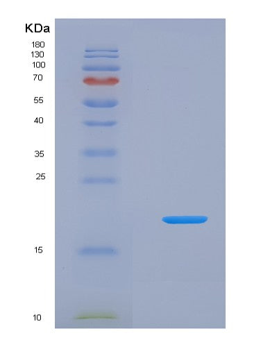SDS-PAGE analysis of Human CRBN (Protein Cereblon) - Recombinant Protein, showing >90% purity under 15% SDS-PAGE (Reduced)