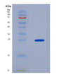 SDS-PAGE analysis of Human LRP2 (Low-Density Lipoprotein Receptor-Related Protein 2) - Recombinant Protein, showing >90% purity under 15% SDS-PAGE (Reduced)