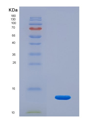 SDS-PAGE analysis of Human ZDHHC5 (Palmitoyltransferase Zdhhc5) - Recombinant Protein, showing >90% purity under 15% SDS-PAGE (Reduced)