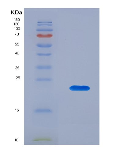 SDS-PAGE analysis of Human APRT (Adenine Phosphoribosyltransferase) - Recombinant Protein, showing >90% purity under 15% SDS-PAGE (Reduced)