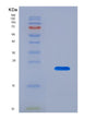 SDS-PAGE analysis of Human APRT (Adenine Phosphoribosyltransferase) - Recombinant Protein, showing >90% purity under 15% SDS-PAGE (Reduced)