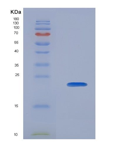 SDS-PAGE analysis of Human CALM3 (Calmodulin-3) - Recombinant Protein, showing >90% purity under 15% SDS-PAGE (Reduced)