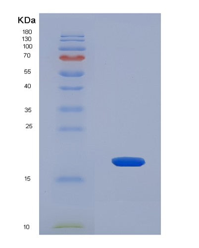 SDS-PAGE analysis of Human PLP2 (Proteolipid Protein 2) - Recombinant Protein, showing >90% purity under 15% SDS-PAGE (Reduced)