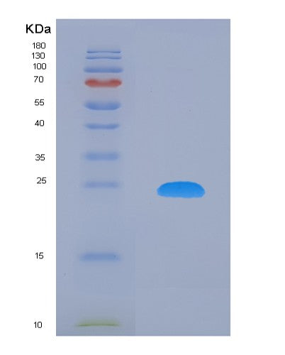 SDS-PAGE analysis of Human MLLT10 (Protein Af-10) - Recombinant Protein, showing >90% purity under 15% SDS-PAGE (Reduced)