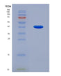 SDS-PAGE analysis of Human POP7 (Ribonuclease P Protein Subunit P20) - Recombinant Protein, showing >90% purity under 15% SDS-PAGE (Reduced)