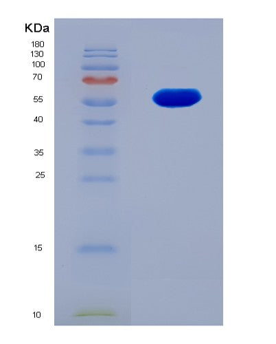 SDS-PAGE analysis of Human CDK12 (Cyclin-Dependent Kinase 12) - Recombinant Protein, showing >90% purity under 15% SDS-PAGE (Reduced)