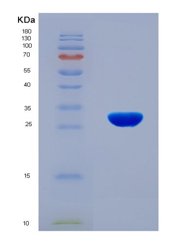 SDS-PAGE analysis of Human CCR6 (C-C Chemokine Receptor Type 6) - Recombinant Protein, showing >90% purity under 15% SDS-PAGE (Reduced)
