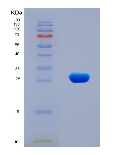 SDS-PAGE analysis of Human CCR1 (C-C Chemokine Receptor Type 1) - Recombinant Protein, showing >90% purity under 15% SDS-PAGE (Reduced)