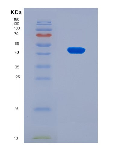 SDS-PAGE analysis of Human SERPINA4 (Kallistatin) - Recombinant Protein, showing >90% purity under 15% SDS-PAGE (Reduced)