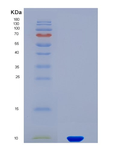 SDS-PAGE analysis of Human IAPP (Islet Amyloid Polypeptide) - Recombinant Protein, showing >90% purity under 15% SDS-PAGE (Reduced)