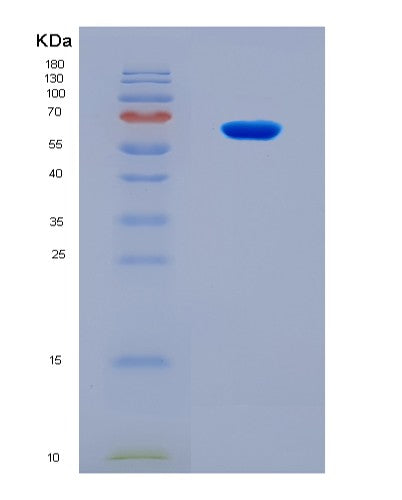 SDS-PAGE analysis of Human CDK1 (Cyclin-Dependent Kinase 1) - Recombinant Protein, showing >90% purity under 15% SDS-PAGE (Reduced)