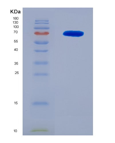 SDS-PAGE analysis of Human CCNB1 (G2/Mitotic-Specific Cyclin-B1) - Recombinant Protein, showing >90% purity under 15% SDS-PAGE (Reduced)