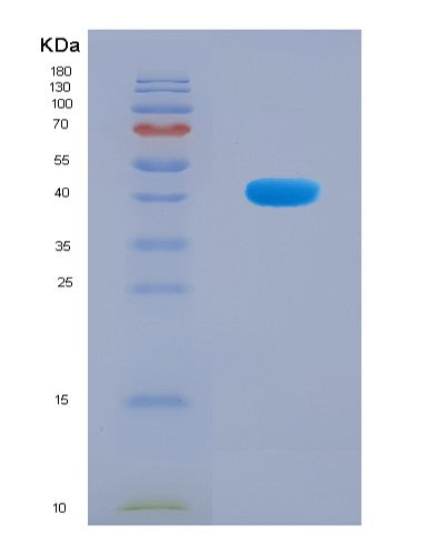 SDS-PAGE analysis of Human RTCA (Rna 3'-Terminal Phosphate Cyclase) - Recombinant Protein, showing >90% purity under 15% SDS-PAGE (Reduced)