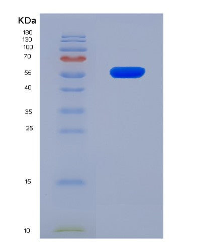 SDS-PAGE analysis of Human PI16 (Peptidase Inhibitor 16) - Recombinant Protein, showing >90% purity under 15% SDS-PAGE (Reduced)