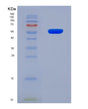 SDS-PAGE analysis of Human PI16 (Peptidase Inhibitor 16) - Recombinant Protein, showing >90% purity under 15% SDS-PAGE (Reduced)