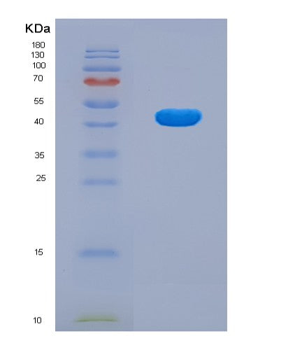 SDS-PAGE analysis of Human CAD (Multifunctional Protein Cad) - Recombinant Protein, showing >90% purity under 15% SDS-PAGE (Reduced)