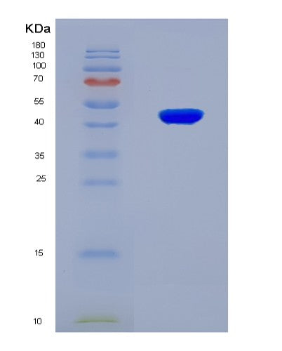 SDS-PAGE analysis of Mouse Hp (Haptoglobin) - Recombinant Protein, showing >90% purity under 15% SDS-PAGE (Reduced)