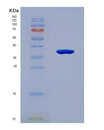 SDS-PAGE analysis of Human OSR2 (Protein Odd-Skipped-Related 2) - Recombinant Protein, showing >90% purity under 15% SDS-PAGE (Reduced)