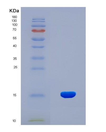 SDS-PAGE analysis of Human MIA (Melanoma-Derived Growth Regulatory Protein) - Recombinant Protein, showing >90% purity under 15% SDS-PAGE (Reduced)