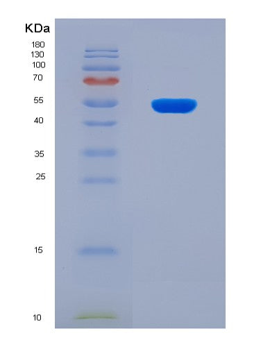 SDS-PAGE analysis of Human KLK6 (Kallikrein-6) - Recombinant Protein, showing >90% purity under 15% SDS-PAGE (Reduced)