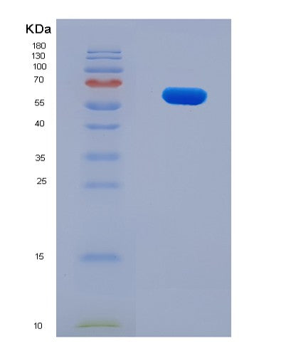 SDS-PAGE analysis of Human LGI4 (Leucine-Rich Repeat Lgi Family Member 4) - Recombinant Protein, showing >90% purity under 15% SDS-PAGE (Reduced)