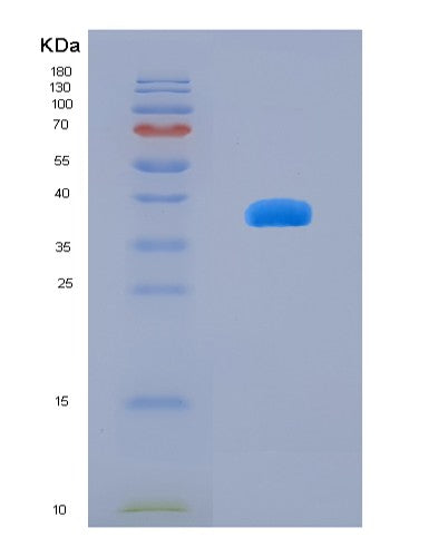SDS-PAGE analysis of Human TPH2 (Tryptophan 5-Hydroxylase 2) - Recombinant Protein, showing >90% purity under 15% SDS-PAGE (Reduced)