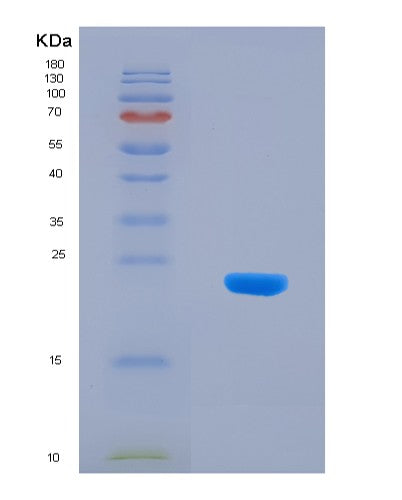 SDS-PAGE analysis of Human RPP25 (Ribonuclease P Protein Subunit P25) - Recombinant Protein, showing >90% purity under 15% SDS-PAGE (Reduced)