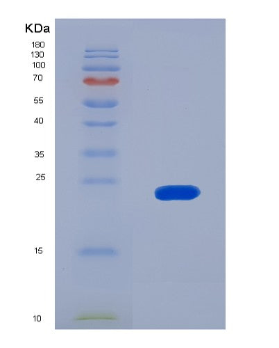 SDS-PAGE analysis of Human IARS1 (Isoleucine--Trna Ligase, Cytoplasmic) - Recombinant Protein, showing >90% purity under 15% SDS-PAGE (Reduced)