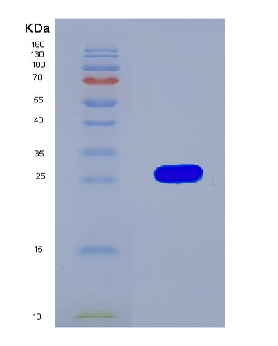 SDS-PAGE analysis of Human DDAH2 (Putative Hydrolase Ddah2) - Recombinant Protein, showing >90% purity under 15% SDS-PAGE (Reduced)