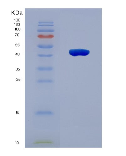 SDS-PAGE analysis of Human NEU2 (Sialidase-2) - Recombinant Protein, showing >90% purity under 15% SDS-PAGE (Reduced)