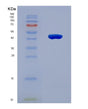 SDS-PAGE analysis of Human NEU2 (Sialidase-2) - Recombinant Protein, showing >90% purity under 15% SDS-PAGE (Reduced)