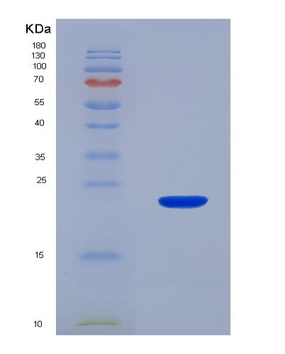 SDS-PAGE analysis of Mouse Itgam (Integrin Alpha-M) - Recombinant Protein, showing >90% purity under 15% SDS-PAGE (Reduced)