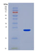 SDS-PAGE analysis of Mouse Itgam (Integrin Alpha-M) - Recombinant Protein, showing >90% purity under 15% SDS-PAGE (Reduced)
