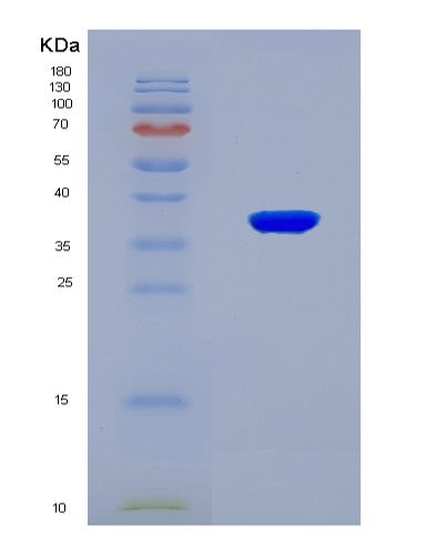 SDS-PAGE analysis of Mouse Cbs (Cystathionine Beta-Synthase) - Recombinant Protein, showing >90% purity under 15% SDS-PAGE (Reduced)