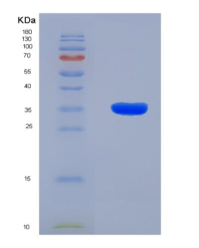 SDS-PAGE analysis of Human IFITM1 (Interferon-Induced Transmembrane Protein 1) - Recombinant Protein, showing >90% purity under 15% SDS-PAGE (Reduced)