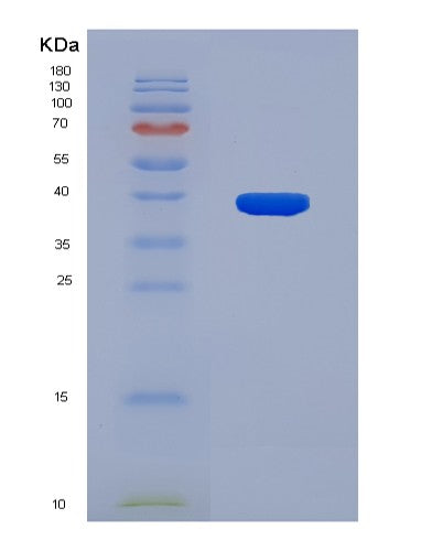 SDS-PAGE analysis of Human SIGMAR1 (Sigma Non-Opioid Intracellular Receptor 1) - Recombinant Protein, showing >90% purity under 15% SDS-PAGE (Reduced)